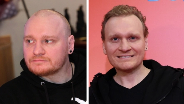Сергей Сафронов рассказал, как помолодел на 20 лет без пластики Сергей Сафронов рассказал, как помолодел на 20 лет без пластики