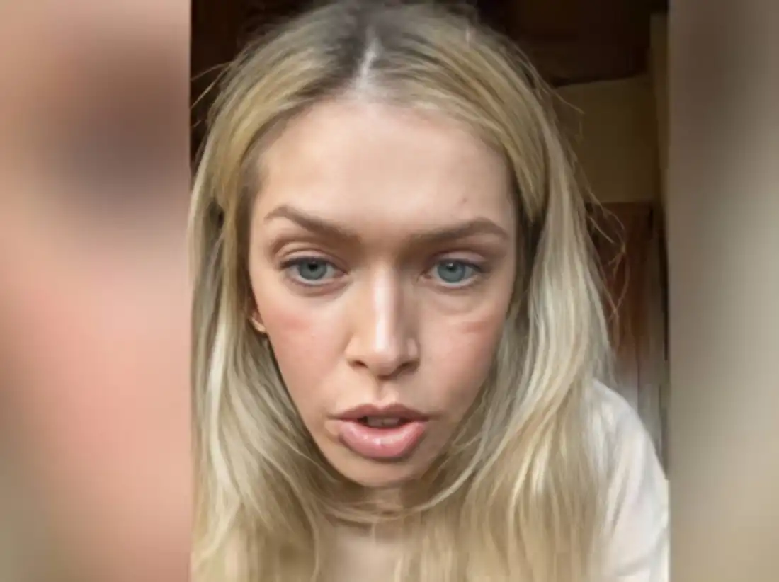 Вновь по-русски заговорила: Брежнева взвыла о своих проблемах в эмиграции Вновь по-русски заговорила: Брежнева взвыла о своих проблемах в эмиграции